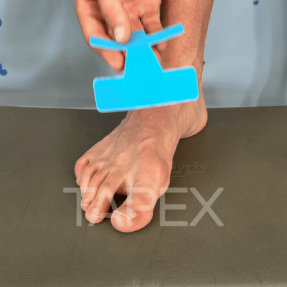 TAPEX™ - Hallux-Valgus