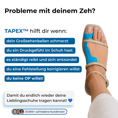TAPEX™ - Hallux-Valgus